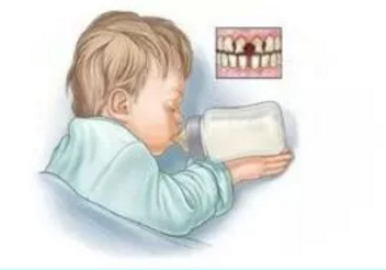 健康科普｜宝宝出现奶瓶龋，谁的错？