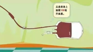 【科普】用“自己”的血治自己的病——臭氧大自血疗法