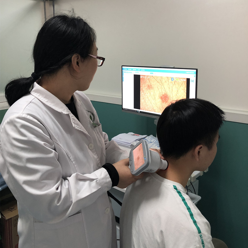 【科普】一镜在手，无所遁形！神器皮肤镜到底有多神？