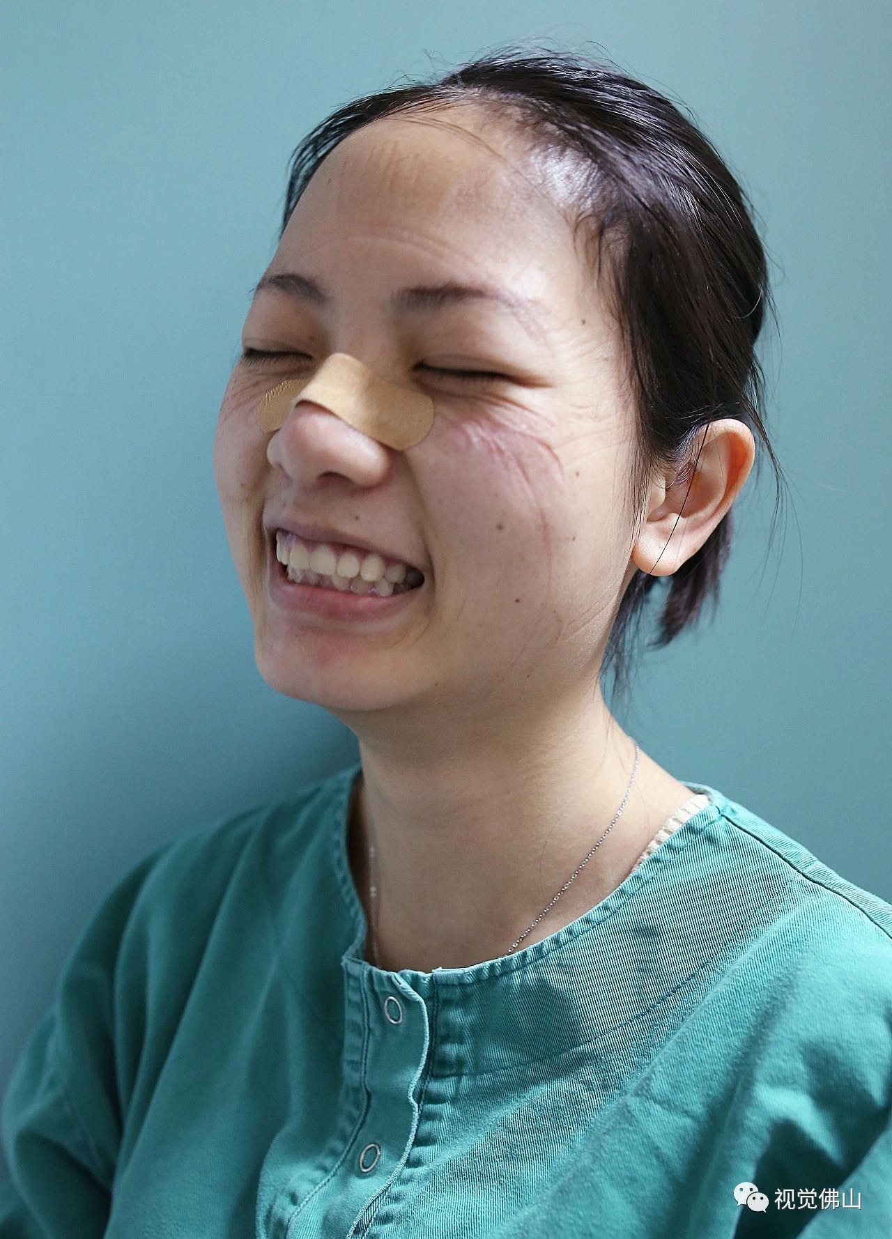 这痕迹真美！是天使的印记，是最美的勋章！