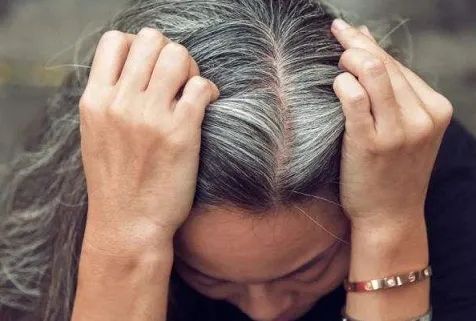 年纪轻轻却白发苍苍，还真是愁出来的？